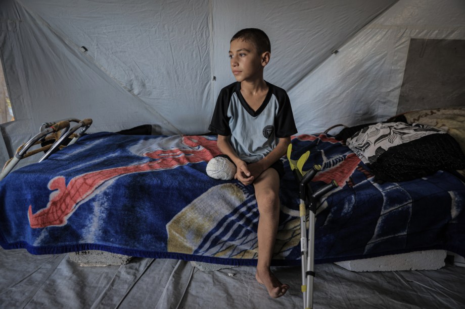AA-20250708-38501645-38501633-GAZAN_BOY_LOSES_LEG_IN_ISRAELI_STRIKE_WHILE_TRYING_TO_GET_AID_FOR_HIS_FAMILY