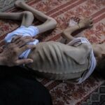 UNICEF: Hampir 9.300 anak Gaza Malnutrisi Akut